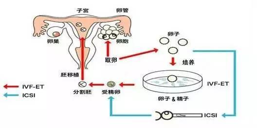 广州供卵生殖中心